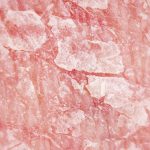 diferenta-psoriazis-lupus