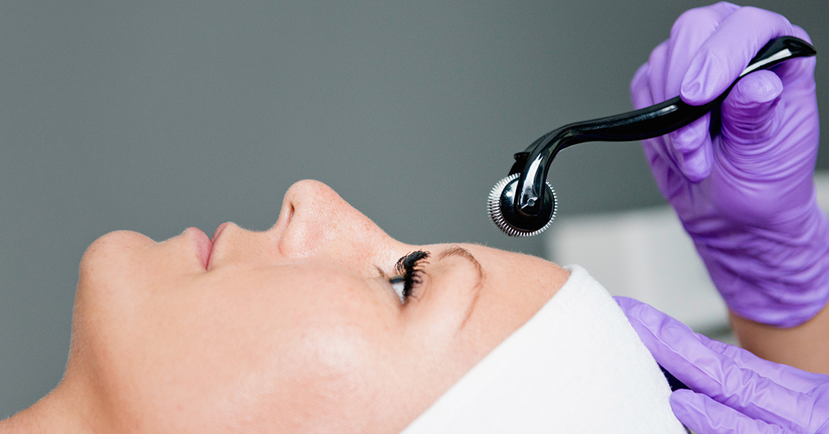 rujuvenare-prin-microneedling